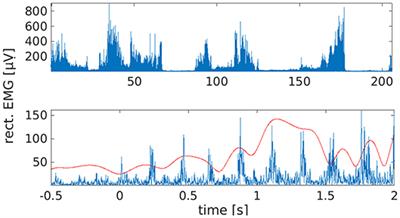 Longitudinal Recordings Reveal Transient Increase of Alpha/Low-Beta Power in the Subthalamic Nucleus Associated With the Onset of Parkinsonian Rest Tremor